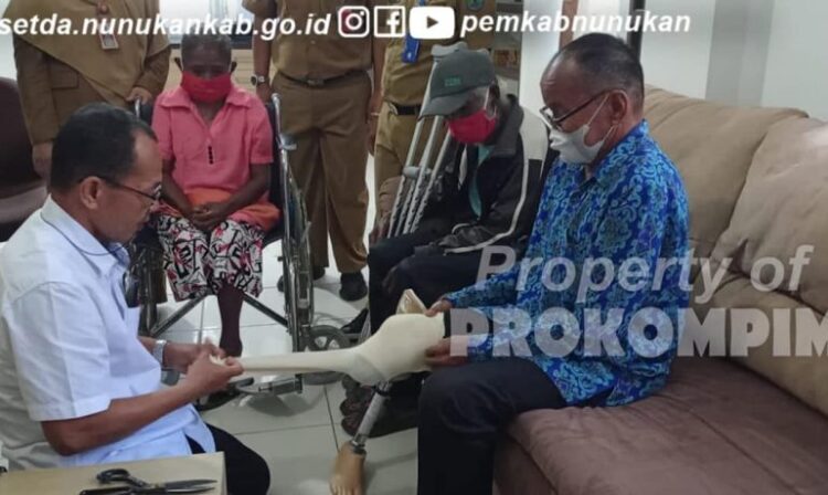 Tiga Orang Penyandang Disabilitas Terima Bantuan Kaki Palsu