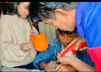 TIM Rescue Damkar Membatu Melepaskan Cincin Dari Jari Tangan Seorang Remaja Pria