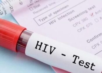 Nih Hasil Pemeriksaan HIV di Tarakan Tahun 2022, Jangan Kaget Yah