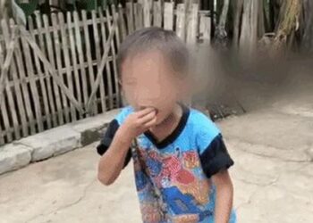Bocah Enam Tahun di Cianjur, Doyan Makan Kertas Rokok