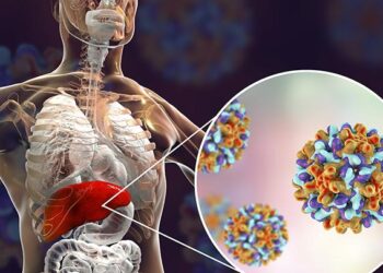Ada Temuan 15 Kasus Hepatitis Akut, Begini Tanggapan Istana